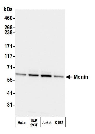 Rabbit anti-Menin Antibody (Bethyl A300-105)